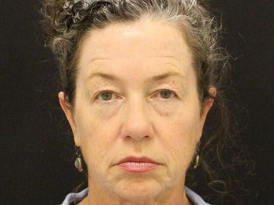 Non-Surgical: Case 5 - Before