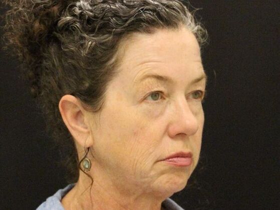 Non-Surgical: Case 5 - Before