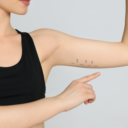 Arm Lift & Reduction Cases