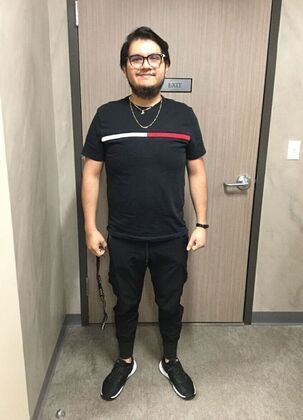 Gastric Sleeve: Case 11 - After