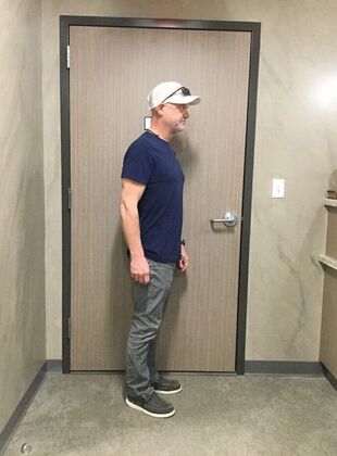 Laparoscopic Gastric Bypass: Case 5 - After