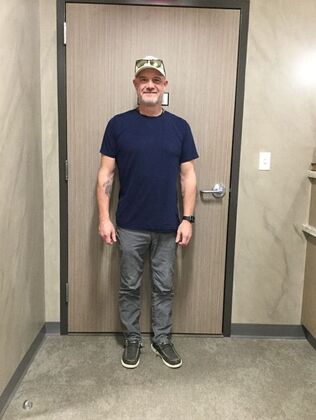 Laparoscopic Gastric Bypass Case 5 - After