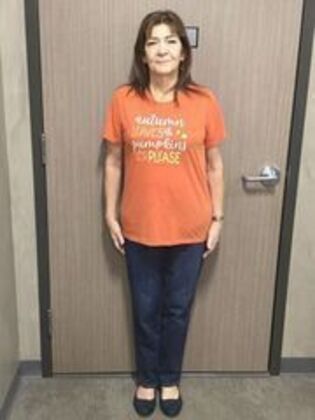 Laparoscopic Gastric Bypass Case 6 - After