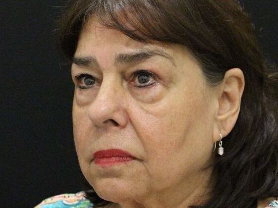 Eyelid Surgery: Case 11 - Before