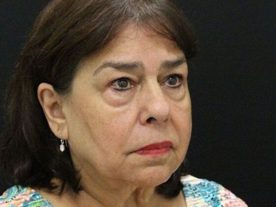 Eyelid Surgery: Case 11 - Before