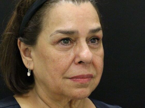 Eyelid Surgery: Case 11 - After