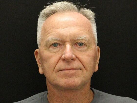 Face & Neck Lifts: Case 32 - After