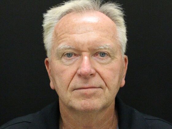 Face & Neck Lifts: Case 32 - Before