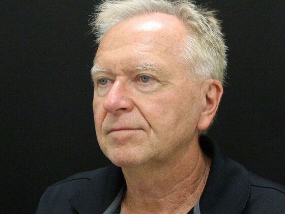 Face & Neck Lifts: Case 32 - Before