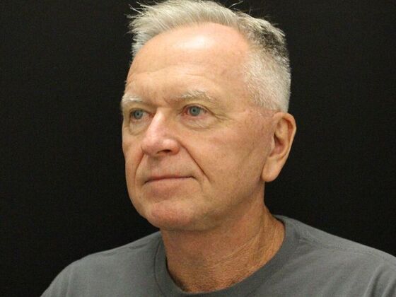 Face & Neck Lifts: Case 32 - After