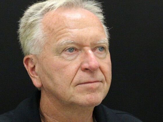 Face & Neck Lifts: Case 32 - Before