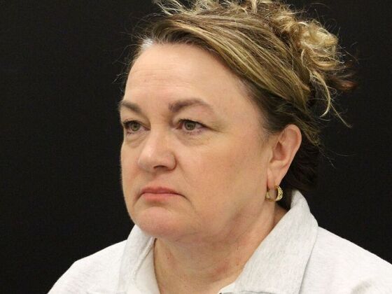 Face & Neck Lifts: Case 33 - After