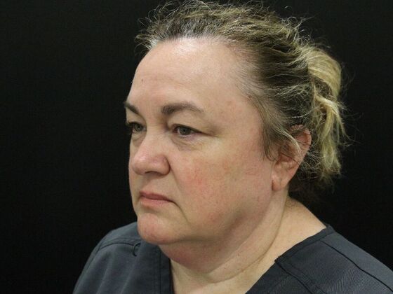 Face & Neck Lifts: Case 33 - Before