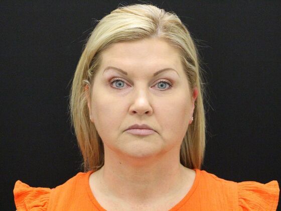 Face & Neck Lifts: Case 34 - Before