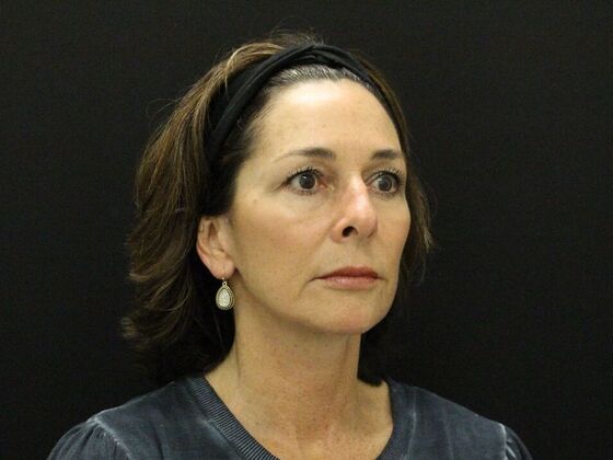 Face & Neck Lifts: Case 35 - After