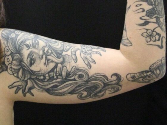 Arm Lift & Reduction: Case 9 - Before