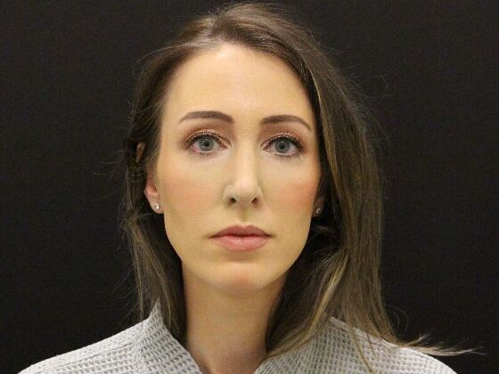 Rhinoplasty: Case 1 - After