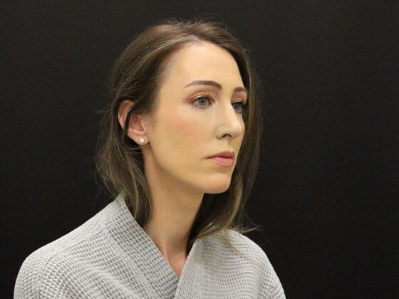 Rhinoplasty: Case 1 - After