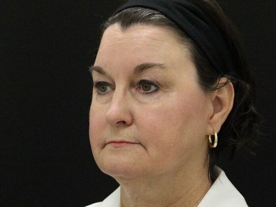 Non-Surgical: Case 6 - Before