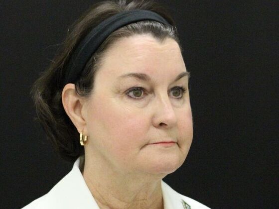 Non-Surgical: Case 6 - Before