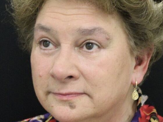 Eyelid Surgery: Case 14 - After