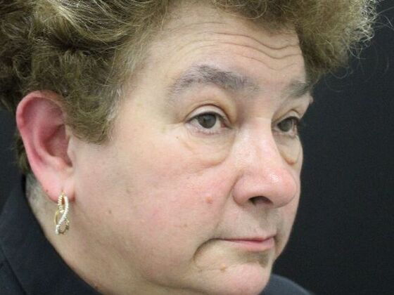 Eyelid Surgery: Case 14 - Before