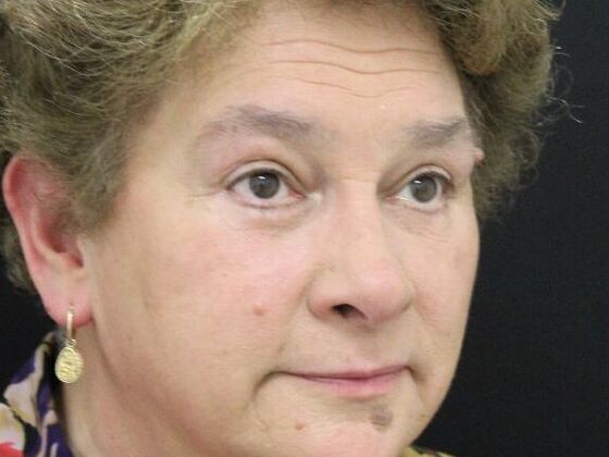 Non-Surgical: Case 8 - After