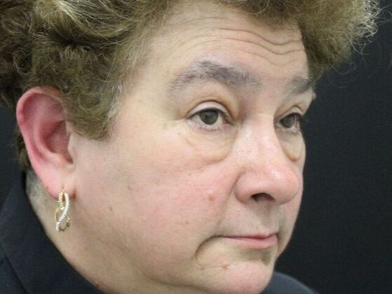 Non-Surgical: Case 8 - Before