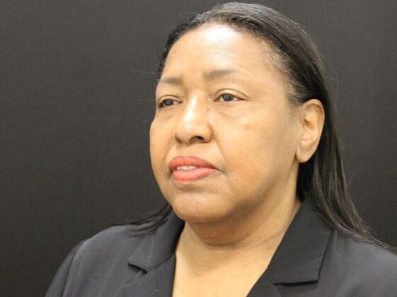 Face & Neck Lifts: Case 40 - Before