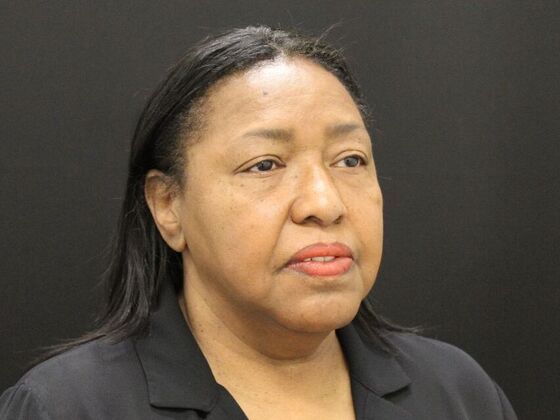 Face & Neck Lifts: Case 40 - Before