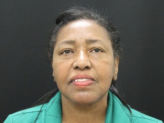 Face & Neck Lifts Case 40 - After