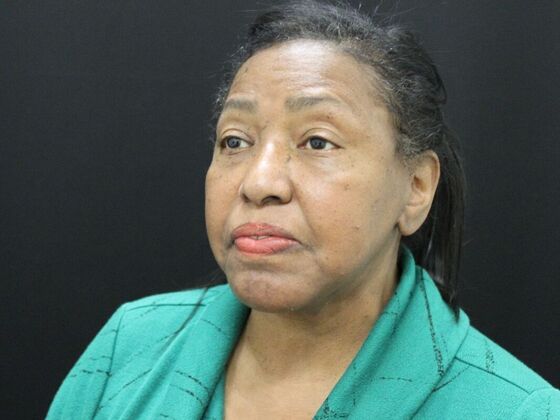 Face & Neck Lifts: Case 40 - After