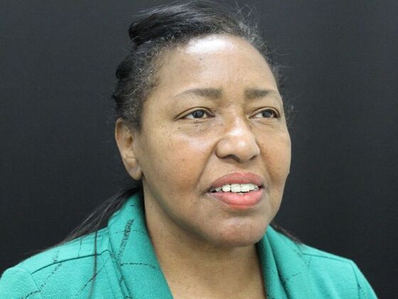 Face & Neck Lifts: Case 40 - After