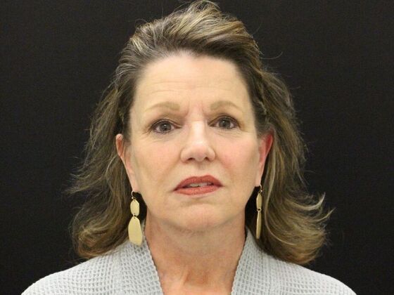 Face & Neck Lifts Case 41 - After