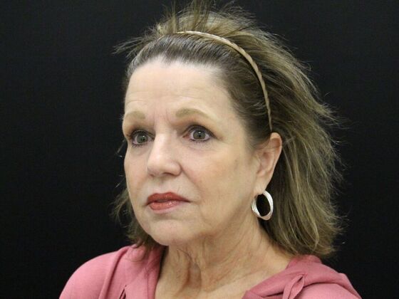 Face & Neck Lifts: Case 41 - Before