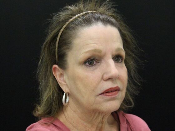 Face & Neck Lifts: Case 41 - Before