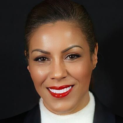 Minimal Prep Porcelain Veneers Vanessa - After