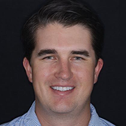 Minimal Prep Porcelain Veneers Pete - After