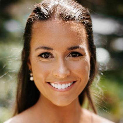 Minimal Prep Porcelain Veneers Stephanie - After