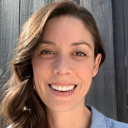 Minimal Prep Porcelain Veneers Philippa - After