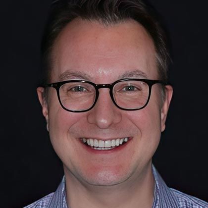 Minimal Prep Porcelain Veneers Thomas - After