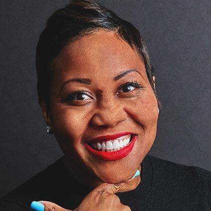 Minimal Prep Porcelain Veneers Roxanne - After