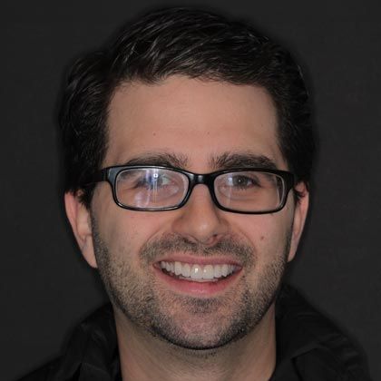 Minimal Prep Porcelain Veneers Camryn - After