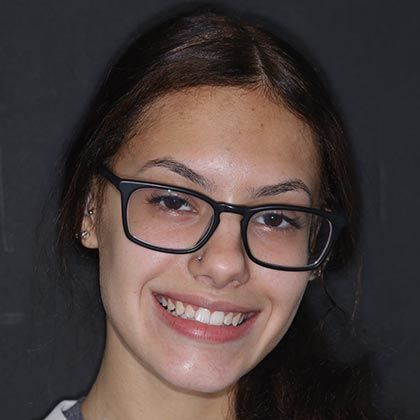 Invisalign / CandidPro Mya - After