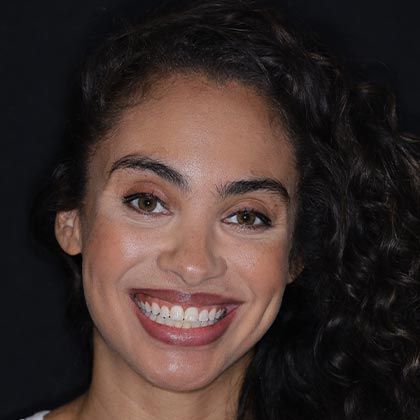 Invisalign / CandidPro Marissa - After