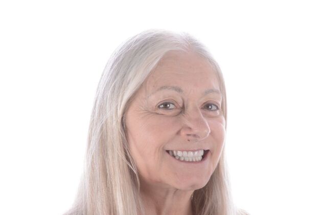 Our Results: All on 6 uppeer and lower patient, - teeth in a day, one day post op photos