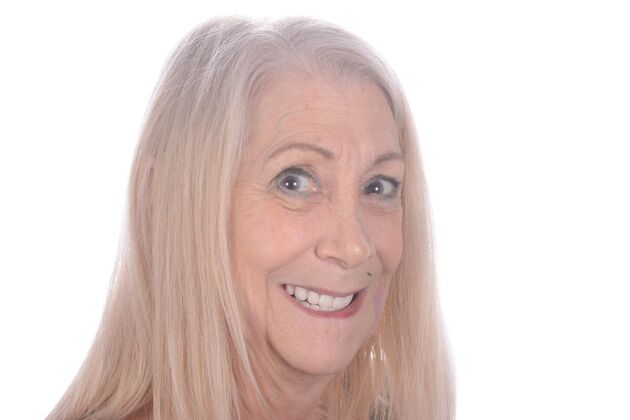 Our Results: ALL ON 5 TEETH IN A DAY - After