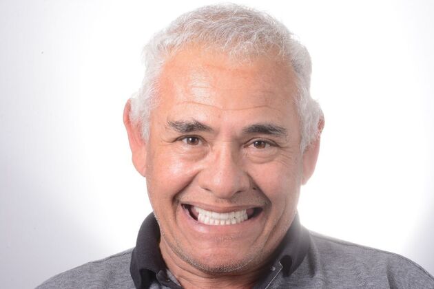 Our Results ALL ON 4 SAME DAY TEETH - After