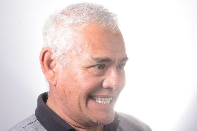 Our Results: ALL ON 4 SAME DAY TEETH - After