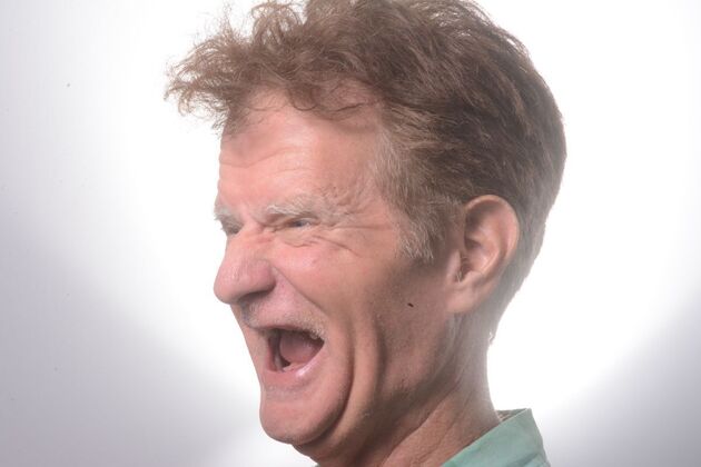 Our Results: ALL ON 6 PATIENT, TEETH IN A DAY - Before